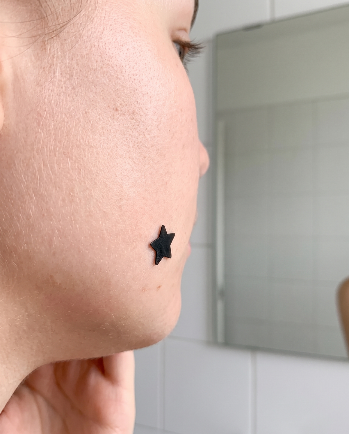 Star hydrocolloid acne patch applied on cheek, clear on-skin shot
