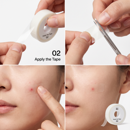 How to use — applying the hydrocolloid tape