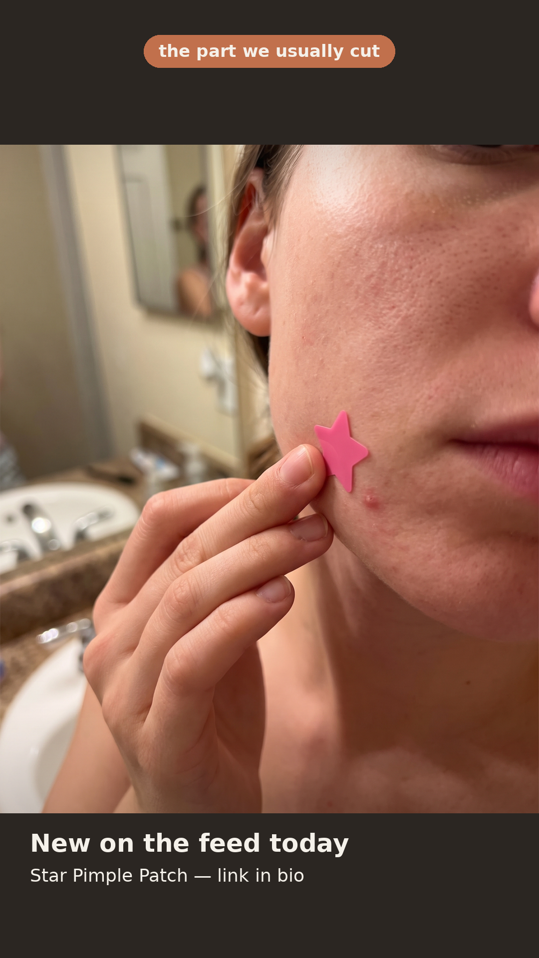 Pelleora Star Pimple Patch POV Story